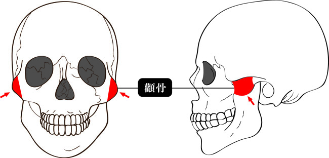 顴骨削骨位置,顴骨削骨部位,顴骨削骨差異