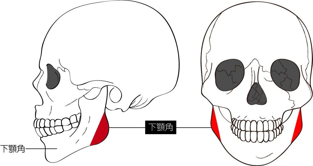 下顎骨角削骨部位,下顎骨角削骨位置,下顎骨角削骨差異