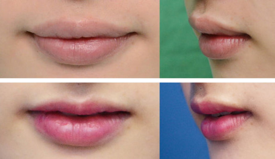 台北-谢东颖医师