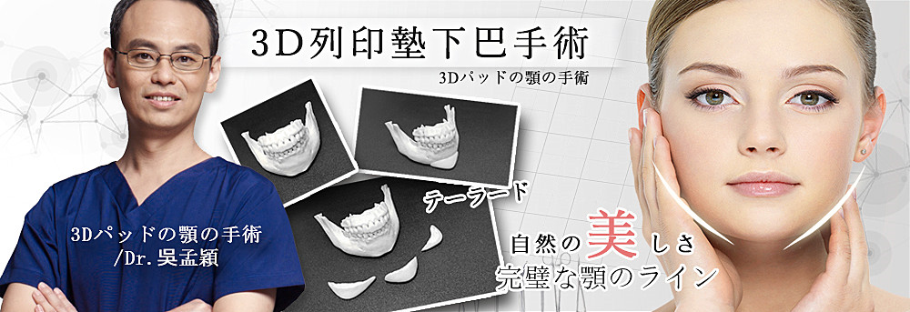 台灣3D列印墊下巴權威醫師推薦3D列印墊下巴吳孟穎