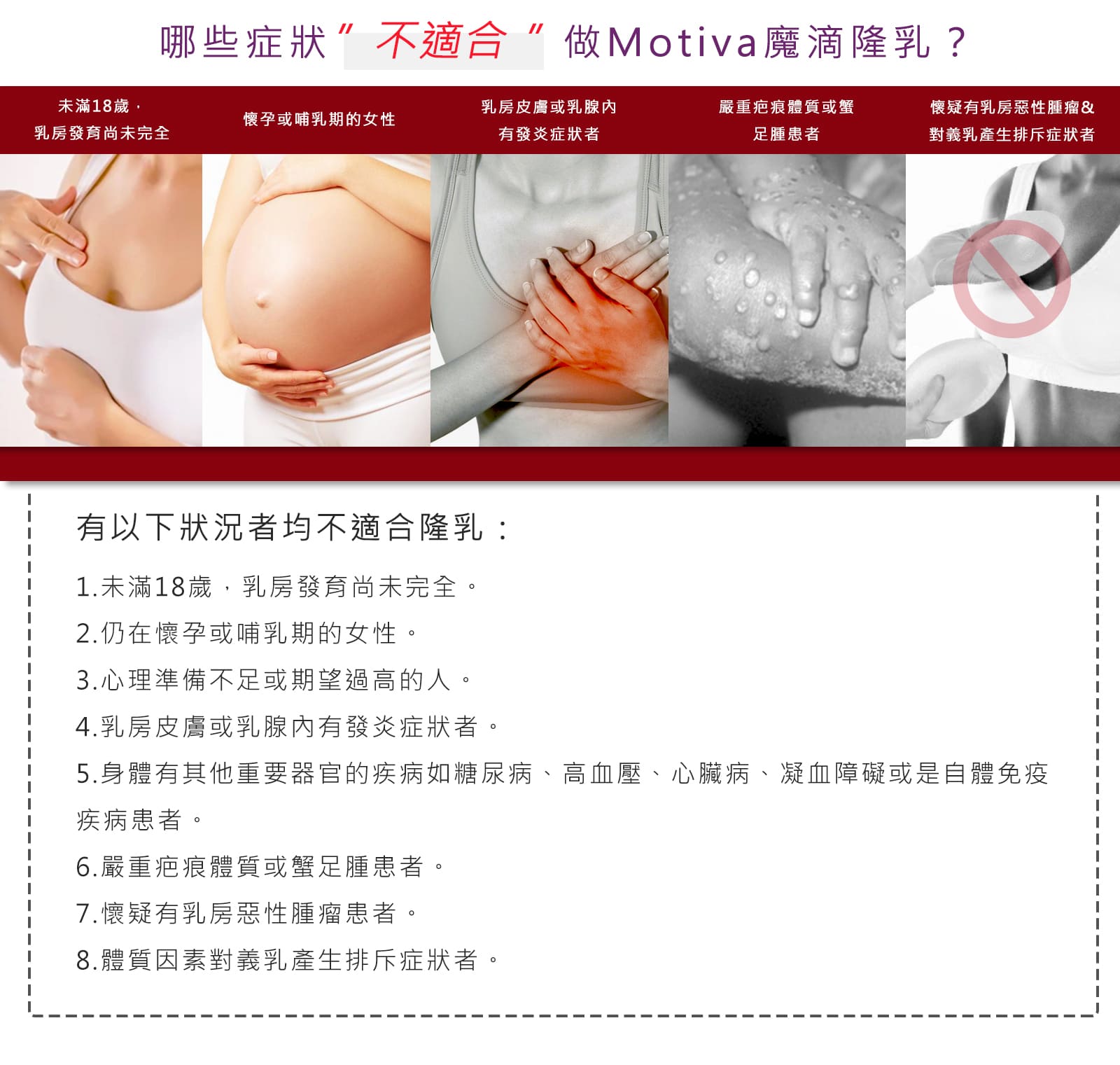 Motiva魔滴隆乳不適合那些消費者