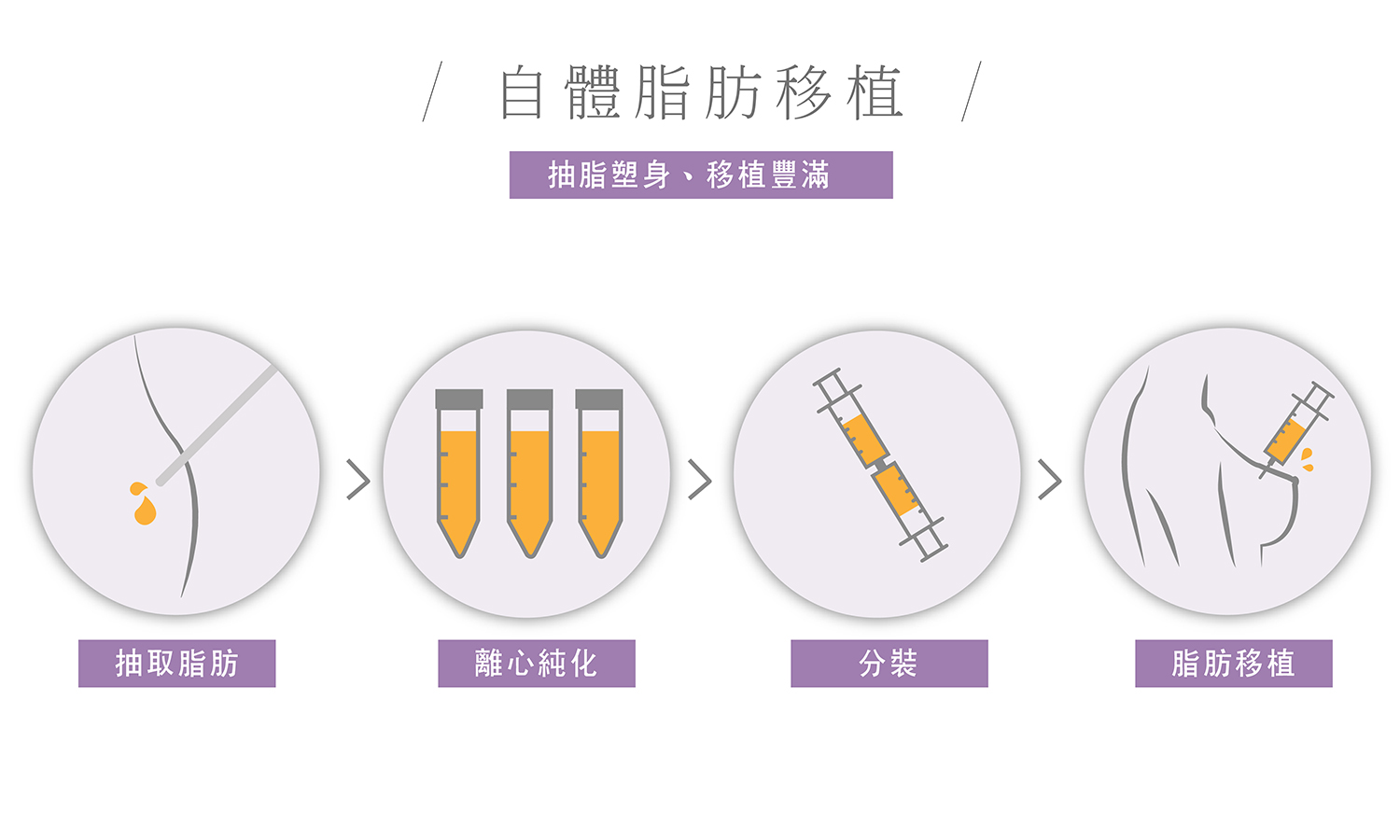 自體脂肪移植過程示意圖