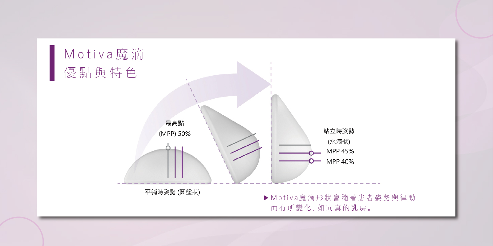 Motiva魔滴手術