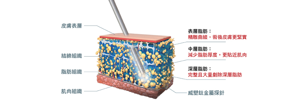 一代威塑與二代威塑的差異