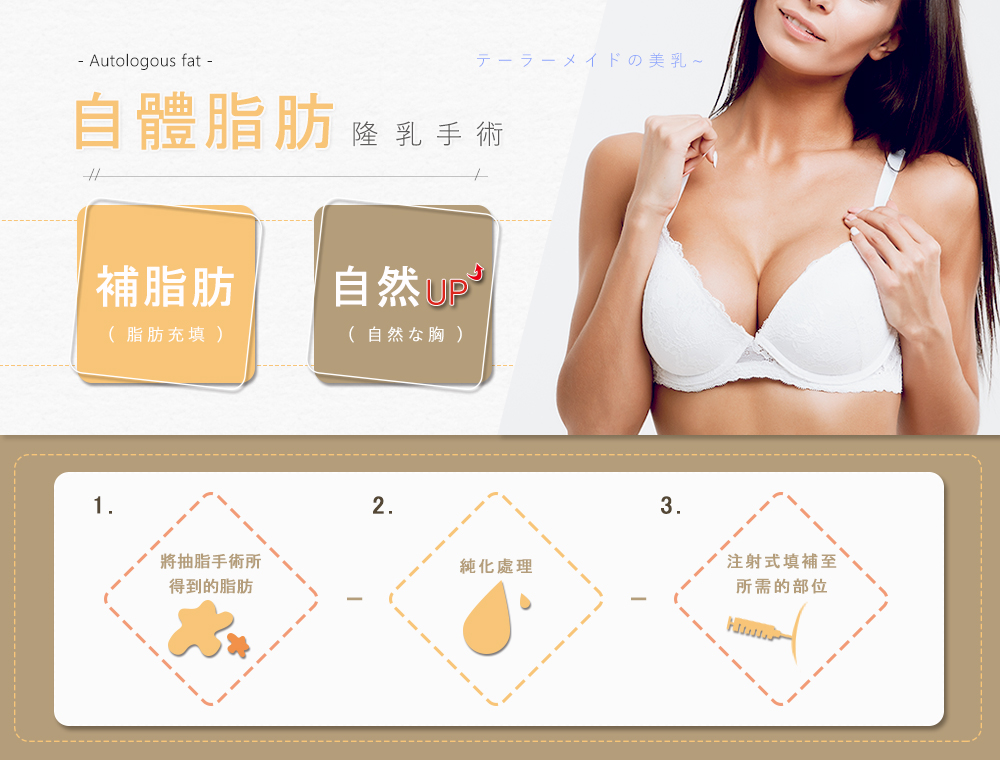 自體脂脂肪隆乳手術介紹