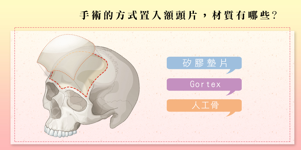 手術的方式置入額頭片，如矽膠墊片、Gortex、人工骨