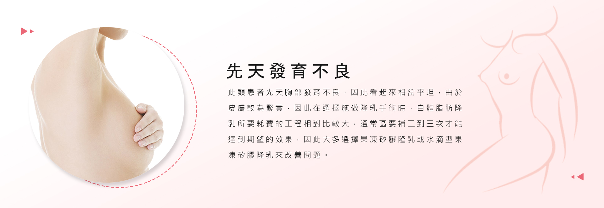 先天發育不良  此類患者先天胸部發育不良，因此看起來相當平坦，由於皮膚較為緊實，因此在選擇施做隆乳手術時，自體脂肪隆乳所要耗費的工程相對比較大，通常區要補二到三次才能達到期望的效果，因此大多選擇果凍矽膠隆乳或水滴型果凍矽膠隆乳來改善問題。