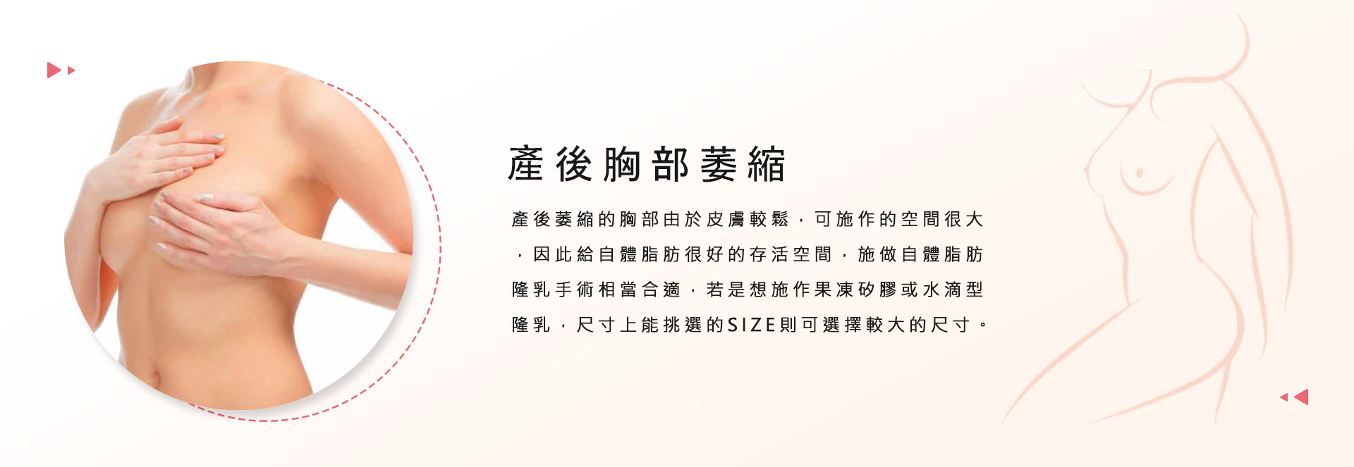 產後胸部萎縮  產後萎縮的胸部由於皮膚較鬆，可施作的空間很大，因此給自體脂肪很好的存活空間，施做自體脂肪隆乳手術相當合適，若是想施作果凍矽膠或水滴型隆乳，尺寸上能挑選的SIZE則可選擇較大的尺寸。