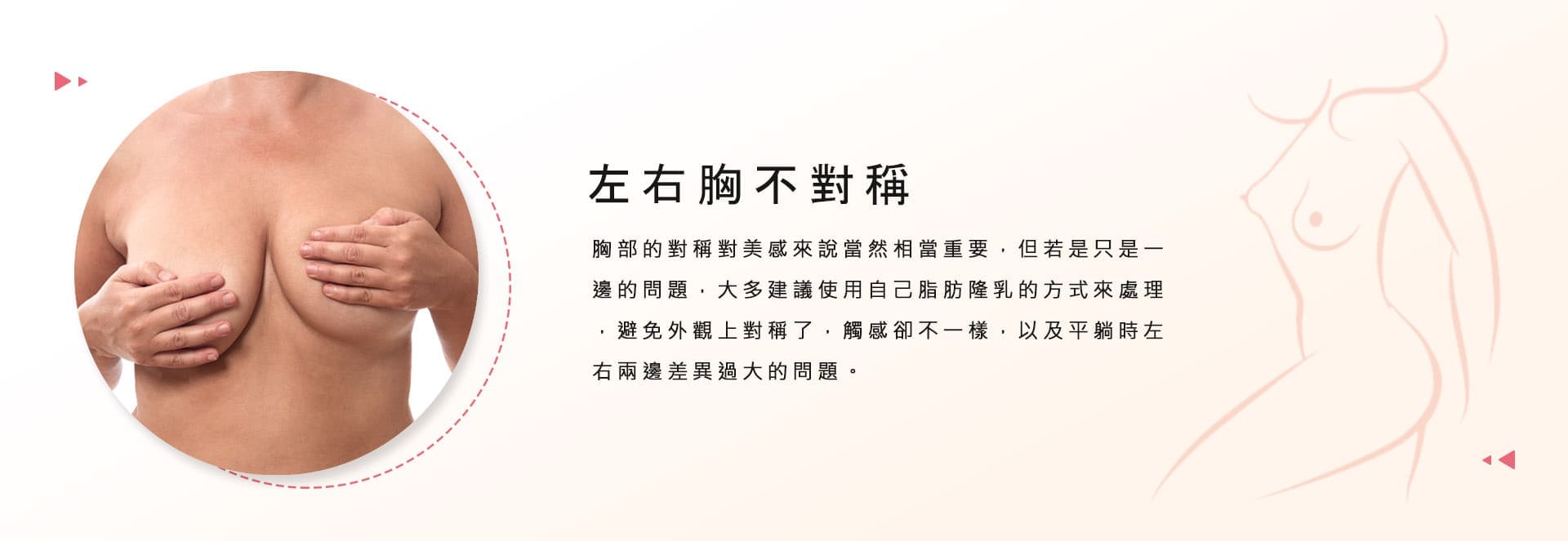 左右胸不對稱  胸部的對稱對美感來說當然相當重要，但若是只是一邊的問題，大多建議使用自己脂肪隆乳的方式來處理，避免外觀上對稱了，觸感卻不一樣，以及平躺時左右兩邊差異過大的問題。