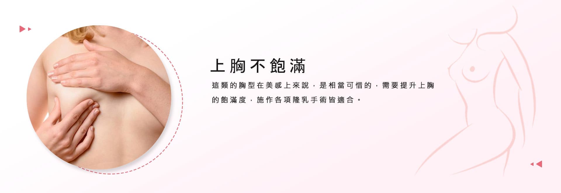 上胸不飽滿  這類的胸型在美感上來說，是相當可惜的，需要提升上胸的飽滿度，施作各項隆乳手術皆適合。