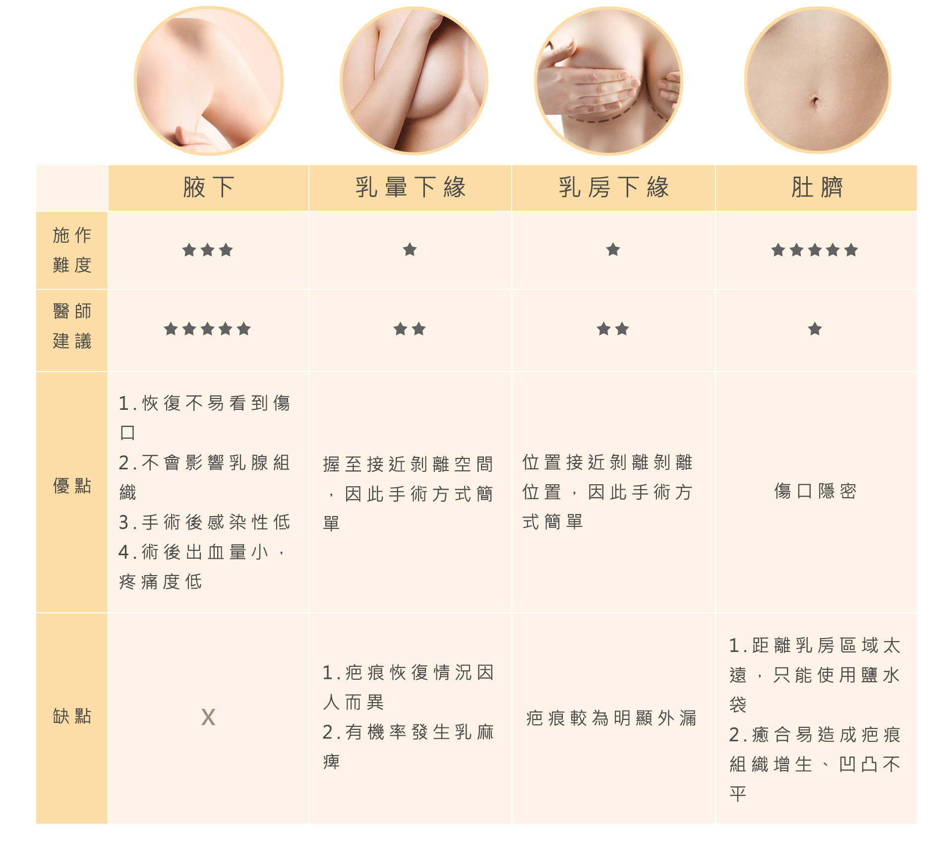 隆乳切口位置比較圖