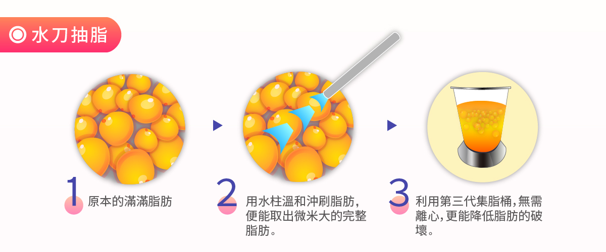 微粹脂二代水刀抽脂介紹