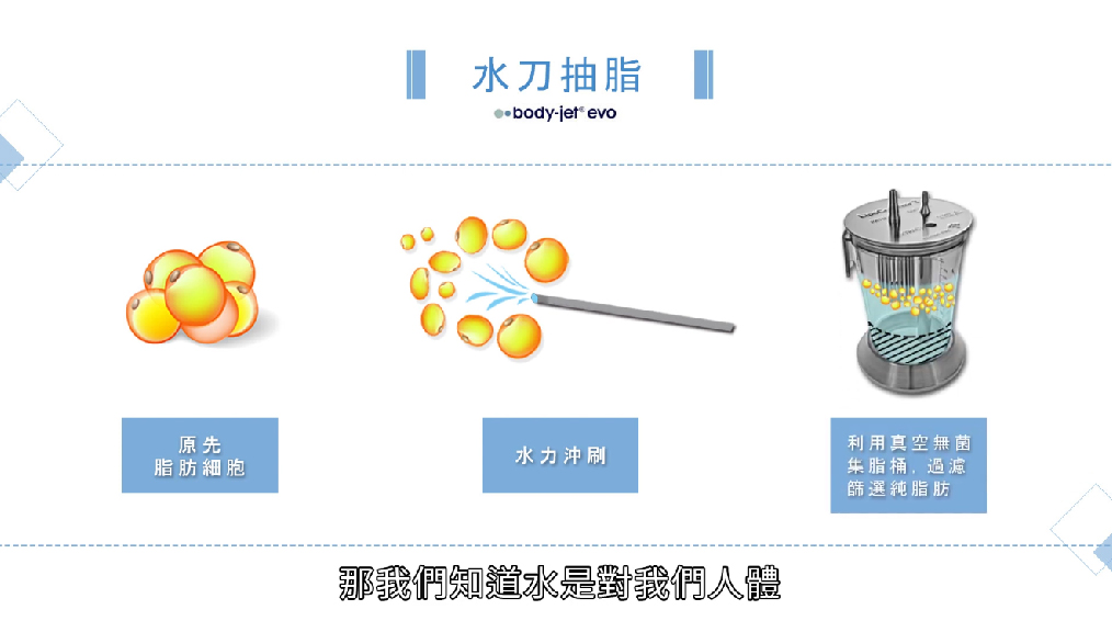 水刀抽脂示意圖