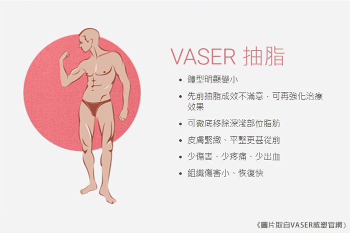 VASER抽脂介紹1